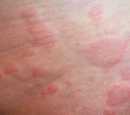 ڇاپاڪو ڏڏر يا سُرڻو