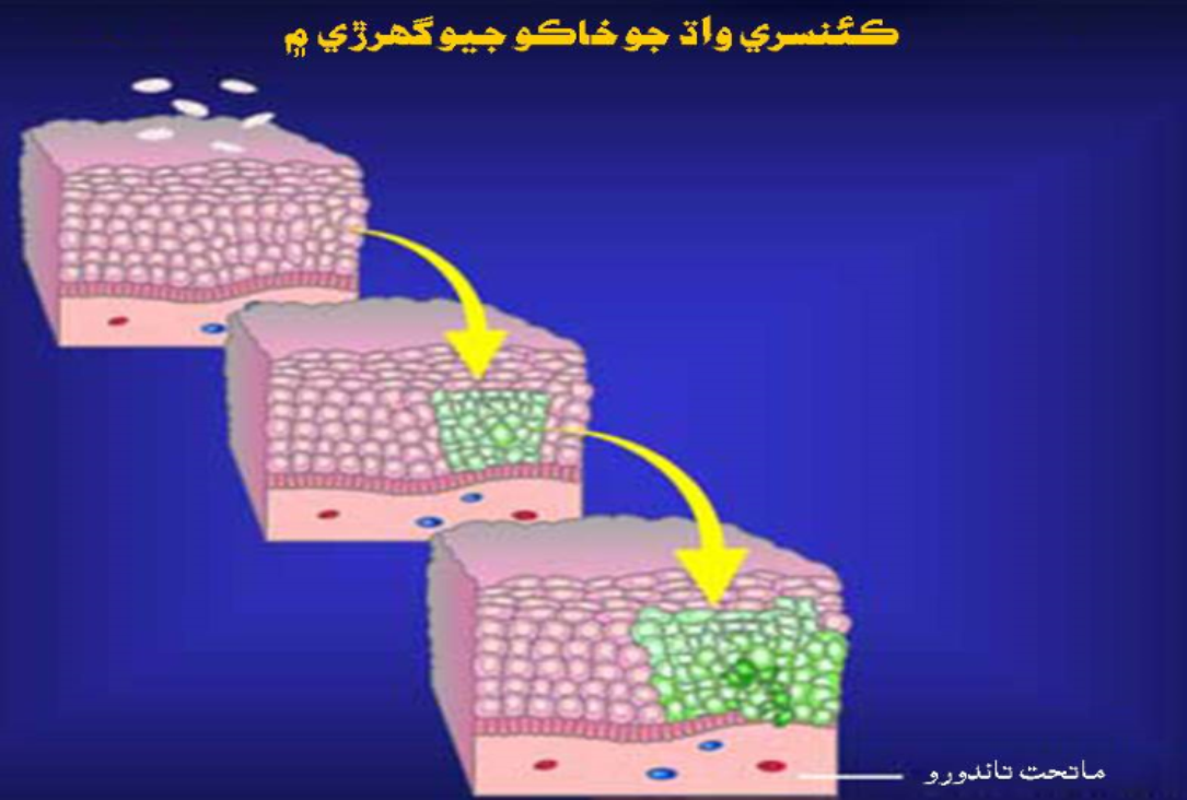 سرطان
